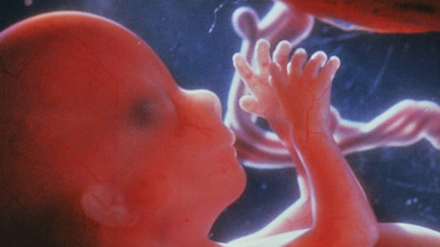 fetus -Four-months-foetus-001